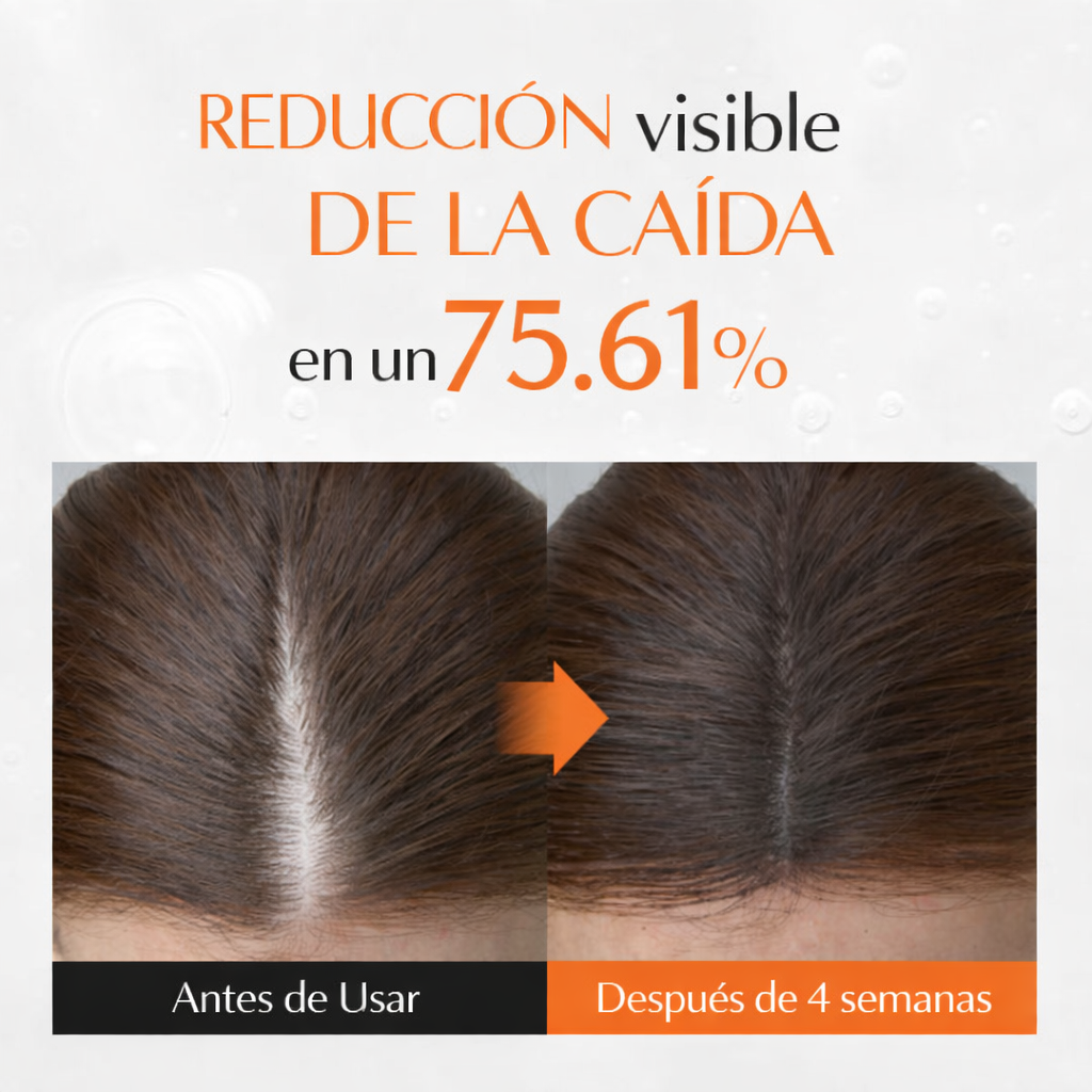 Lilyeve Growturn™ | Activa Crecimiento + Fortalece Raíz + Más Densidad