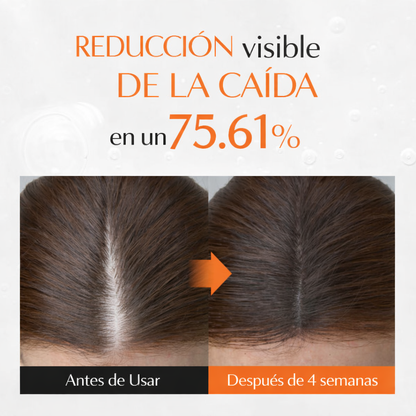 Lilyeve Growturn™ | Activa Crecimiento + Fortalece Raíz + Más Densidad