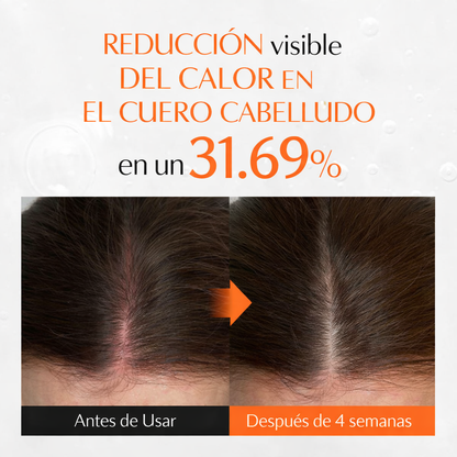 Lilyeve Growturn™ | Activa Crecimiento + Fortalece Raíz + Más Densidad