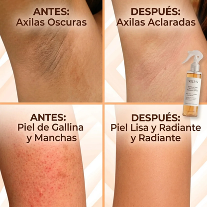 Velyn Exfoliating Body Peel Spray