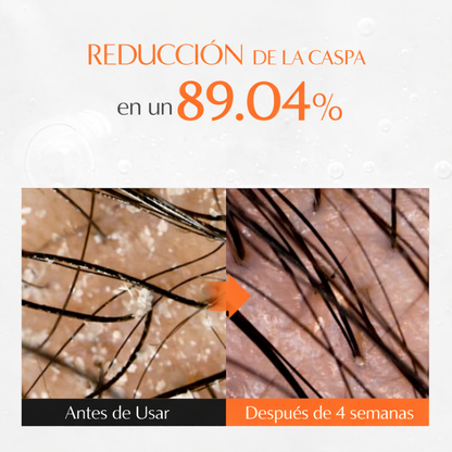 Lilyeve Growturn™ | Activa Crecimiento + Fortalece Raíz + Más Densidad