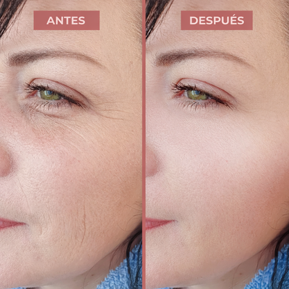 VELYN™ Oferta 2x1 Multi Balm Anti-Arrugas Viral + Efecto Lifting Instantáneo