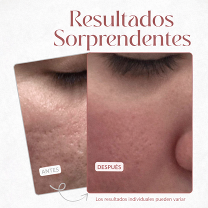VELYN™ Oferta 2x1 Balm Anti-Poros Viral + Efecto Piel Filtro Instantáneo