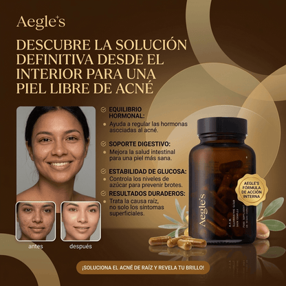 Aeglés™ Tratamiento Anti-Acné Desde la Raíz + Piel Clara Sin Brotes